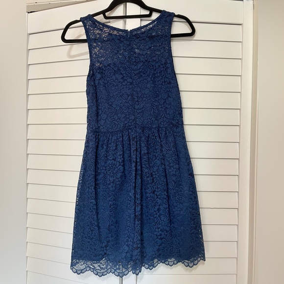 Forever 21 Blue Lace Dress - Picture 2 of 4